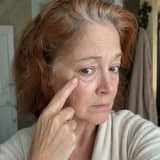 Woman examining under-eye puffiness in a bathroom mirror