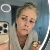 Woman looking at irritated under-eye skin after retinol use