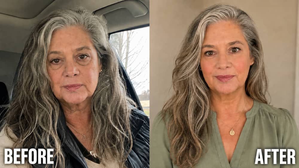 Before and after results for full eye area brightness